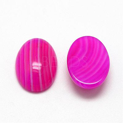 Natural Striped Agate/Banded Agate Cabochons G-R415-13x18-13-1